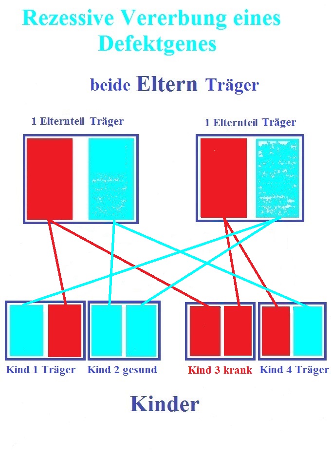 Erbfehler